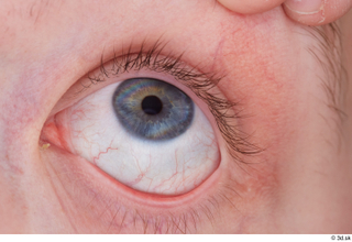 HD Eyes Casey Schneider eye eyelash iris pupil skin texture…